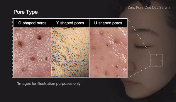 ZERO PORE ONE DAY PEPTIDE SERUM 30 ml