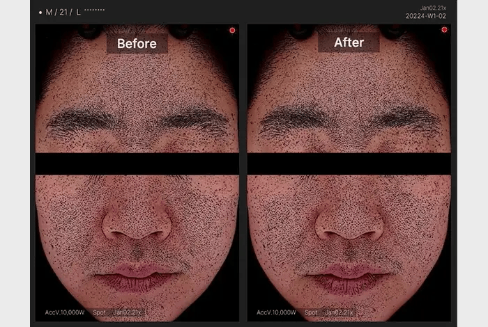ZERO PORE PAD 2.0
