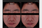 ZERO PORE PAD 2.0